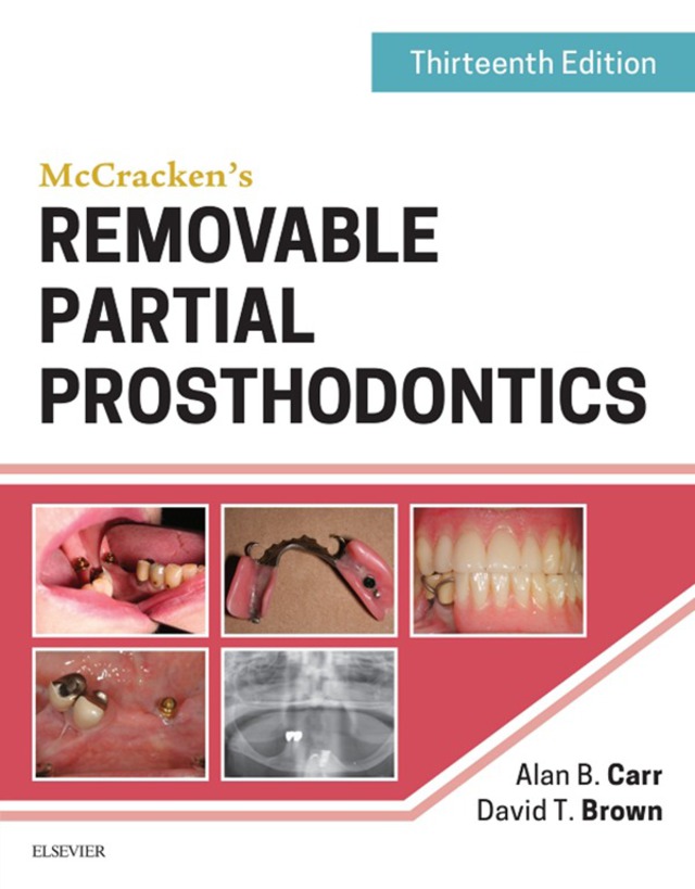 Mccrackens Removable Partial Prosthodontics