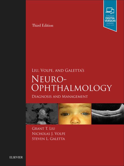 Cover image for book Liu, Volpe, and Galetta’s Neuro-Ophthalmology E-Book