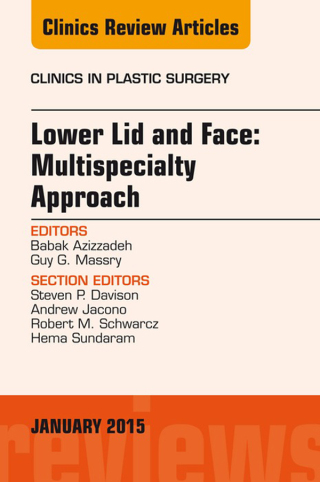 Lower Lid and Midface: Multispecialty Approach, An Issue of Clinics in Plastic Surgery
