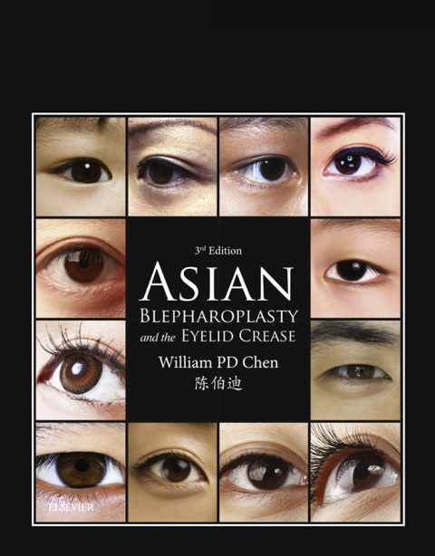 Cover image for book Asian Blepharoplasty and the Eyelid Crease E-Book