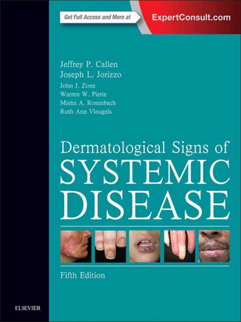 Cover image for book Dermatological Signs of Systemic Disease