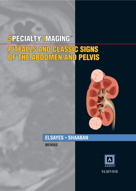 Cover image for book Specialty Imaging: Pitfalls and Classic Signs of the Abdomen and Pelvis