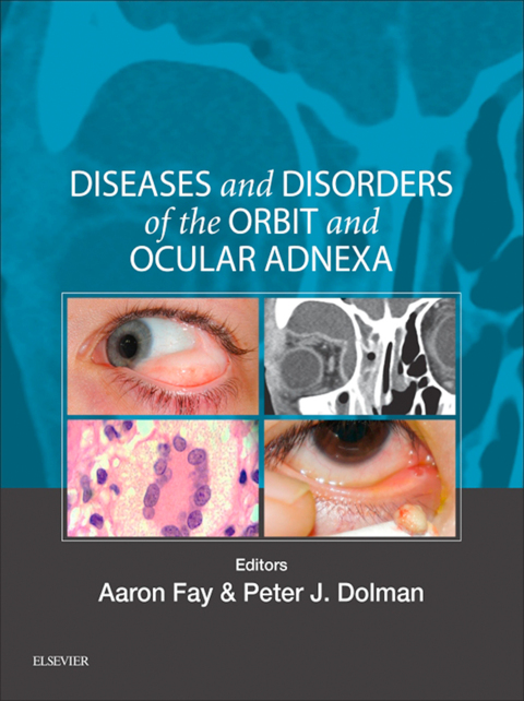 Cover image for book Diseases and Disorders of the Orbit and Ocular Adnexa