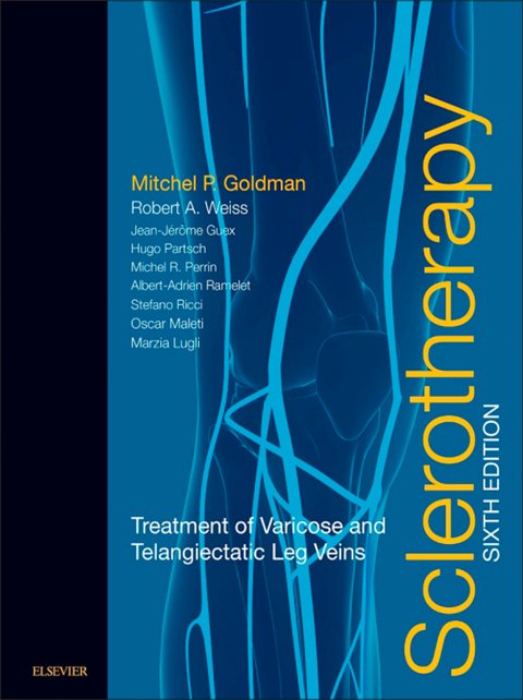 Cover image for book Sclerotherapy: Treatment of Varicose and Telangiectatic Leg Veins (Expert Consult)