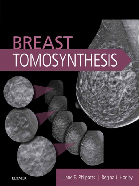 Cover image for book Breast Tomosynthesis