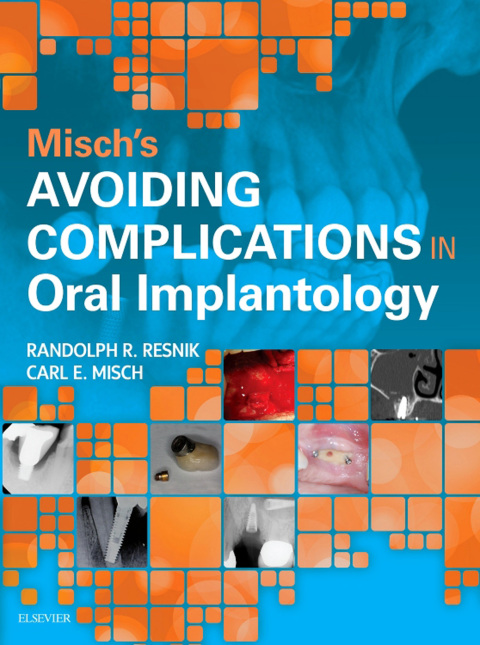 Cover image for book Misch's Avoiding Complications in Oral Implantology