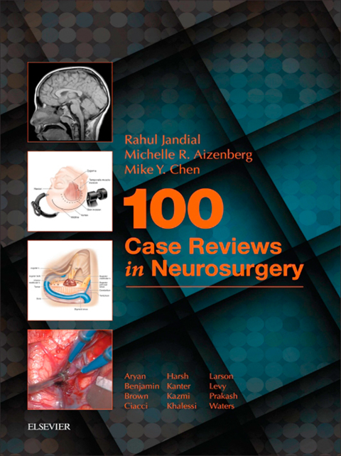 Cover image for book 100 Case Reviews in Neurosurgery