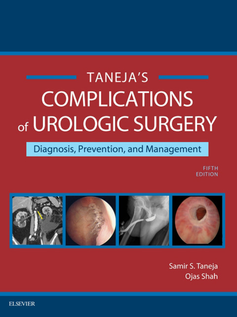 Cover image for book Complications of Urologic Surgery