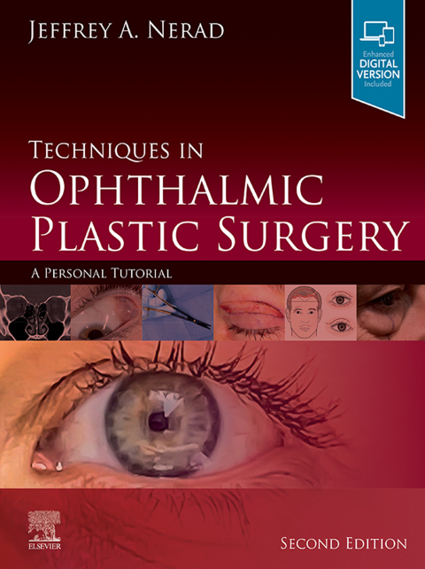 Cover image for book Techniques in Ophthalmic Plastic Surgery E-Book
