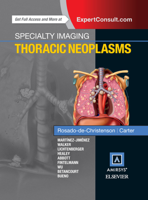 Cover image for book Specialty Imaging: Thoracic Neoplasms