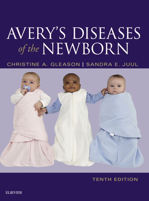 Cover image for book Avery's Diseases of the Newborn E-Book