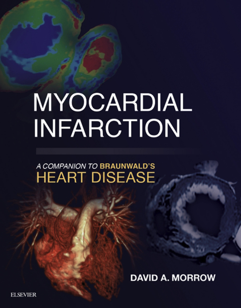 Cover image for book Myocardial Infarction: A Companion to Braunwald's Heart Disease