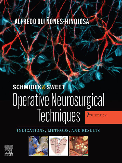 Cover image for book Schmidek and Sweet: Operative Neurosurgical Techniques