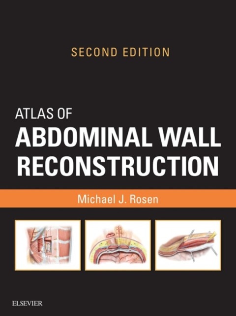 Atlas of Abdominal Wall Reconstruction E-Book 
