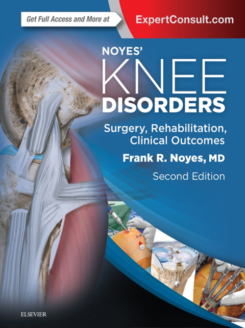 Cover image for book Noyes' Knee Disorders: Surgery, Rehabilitation, Clinical Outcomes