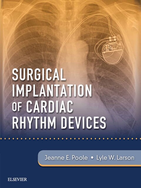 Cover image for book Surgical Implantation of Cardiac Rhythm Devices
