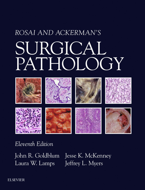 Rosai and Ackerman's Surgical Pathology 