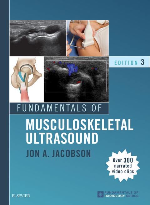 Cover image for book Fundamentals of Musculoskeletal Ultrasound