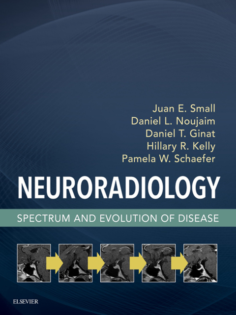 Cover image for book Neuroradiology