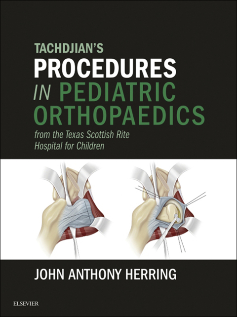 Cover image for book Tachdjian's Procedures in Pediatric Orthopaedics