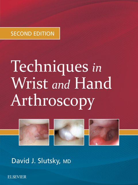 Cover image for book Techniques in Wrist and Hand Arthroscopy