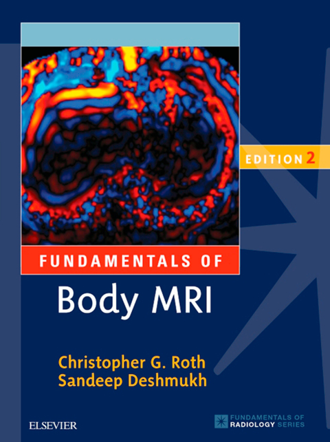 Cover image for book Fundamentals of Body MRI
