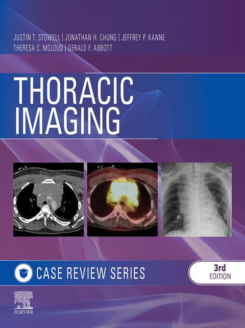 Cover image for book Thoracic Imaging: Case Review Series