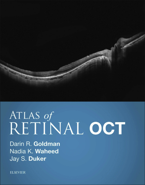 Cover image for book Atlas of Retinal OCT