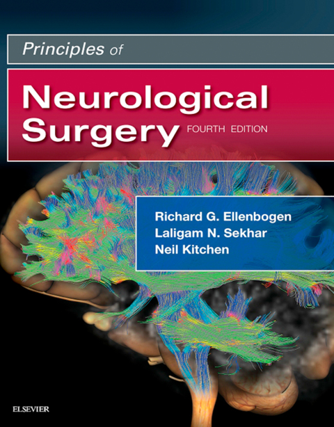 Cover image for book Principles of Neurological Surgery