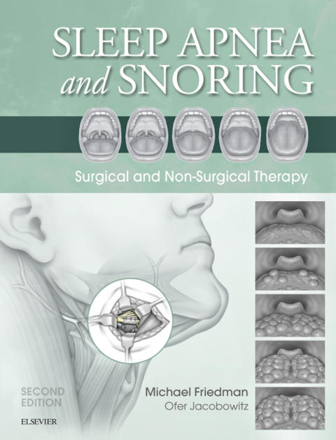 Cover image for book Sleep Apnea and Snoring