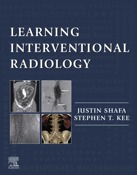 Cover image for book Learning Interventional Radiology