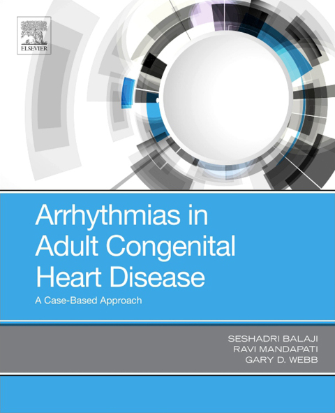 Arrhythmias in Adult Congenital Heart Disease 