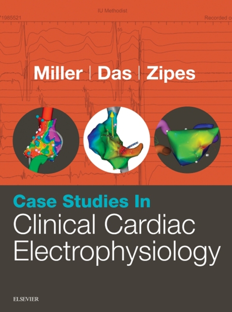 Case Studies in Clinical Cardiac Electrophysiology 
