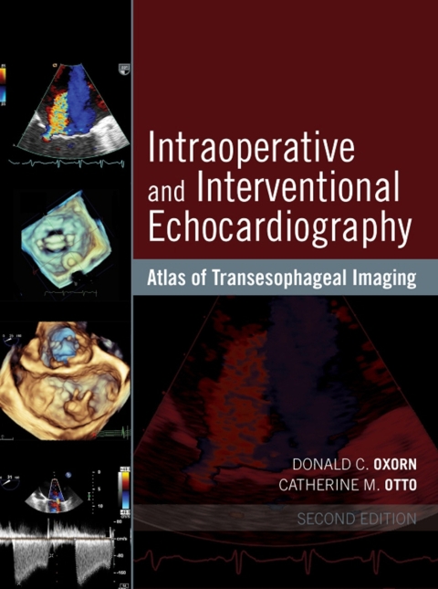 Cover image for book Intraoperative and Interventional Echocardiography