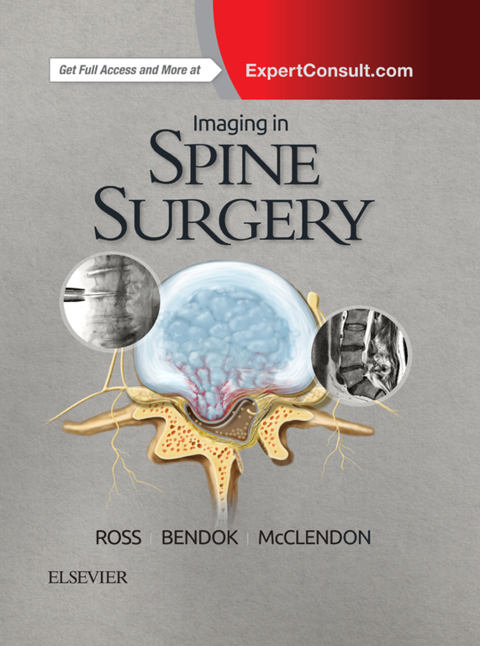 Imaging in Spine Surgery 