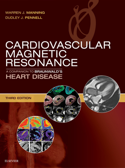 Cover image for book Cardiovascular Magnetic Resonance