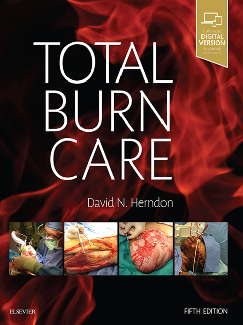 Cover image for book Total Burn Care