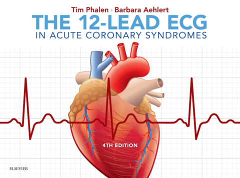 Cover image for book The 12-Lead ECG in Acute Coronary Syndromes