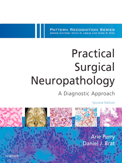 Cover image for book Practical Surgical Neuropathology: A Diagnostic Approach