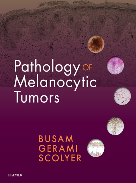 Cover image for book Pathology of Melanocytic Tumors E-Book