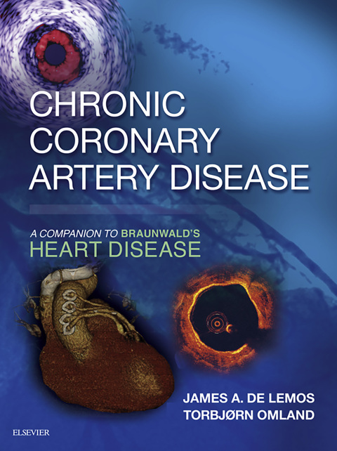 Cover image for book Chronic Coronary Artery Disease