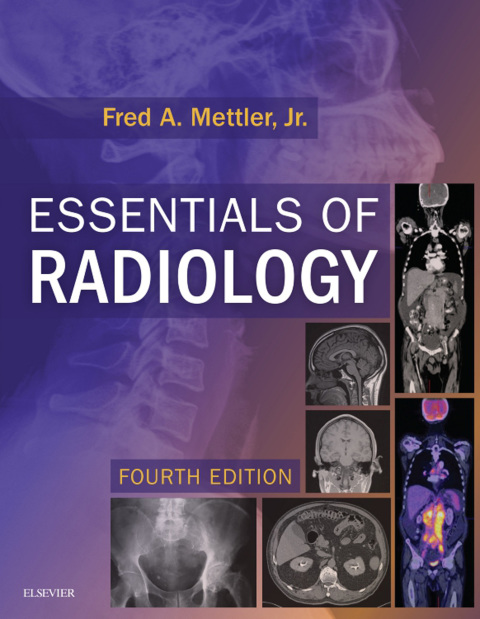 Cover image for book Essentials of Radiology Elsevier eBook on VitalSource