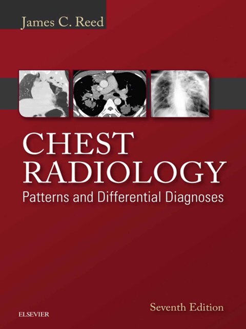 Cover image for book Chest Radiology