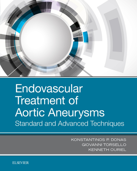 Cover image for book Endovascular Treatment of Aortic Aneurysms