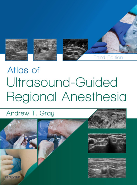 Cover image for book Atlas of Ultrasound-Guided Regional Anesthesia