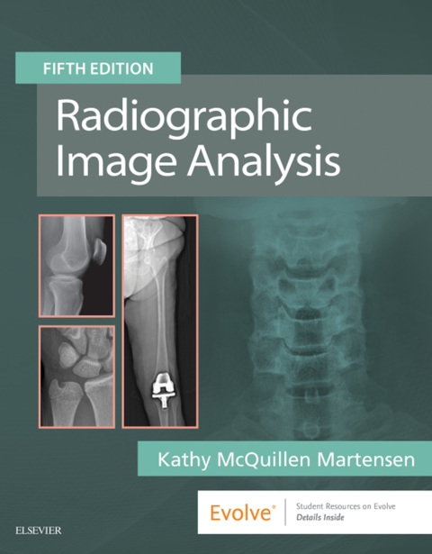 Cover image for book Radiographic Image Analysis