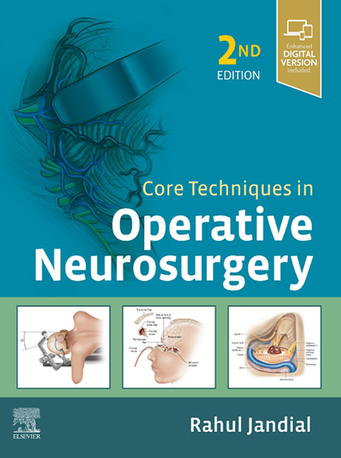 Cover image for book Core Techniques in Operative Neurosurgery
