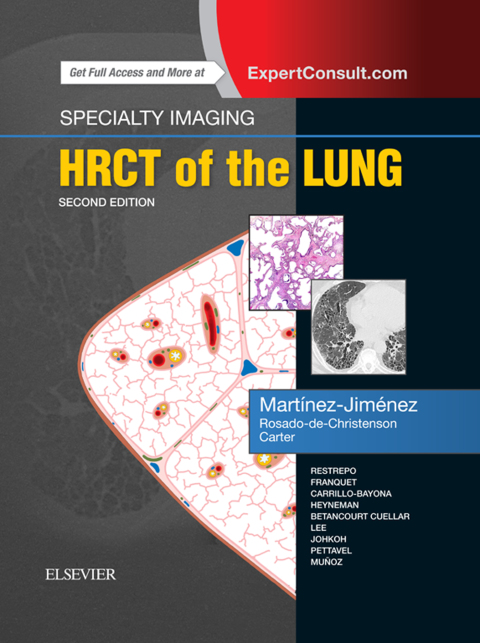 Cover image for book Specialty Imaging: HRCT of the Lung