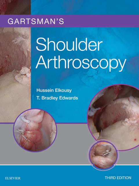 Cover image for book Gartsman's Shoulder Arthroscopy E-Book