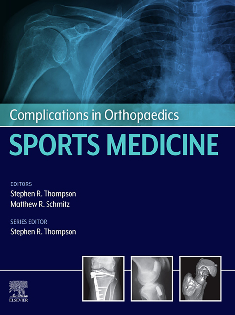 Complications in Orthopaedics: Sports Medicine 